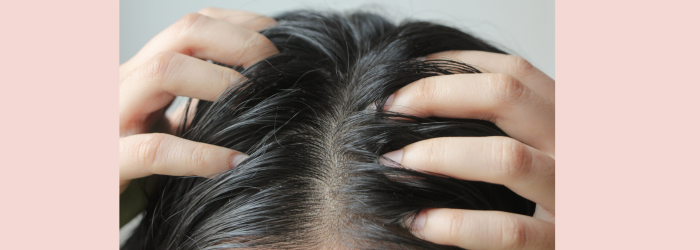 Woman touching scalp